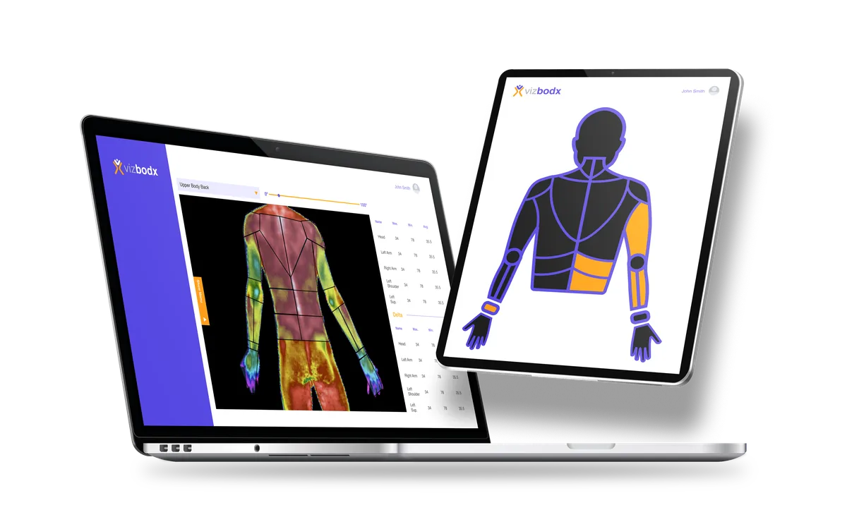 Vizbodx medical thermography platform — AI-powered thermal body scan analysis dashboard