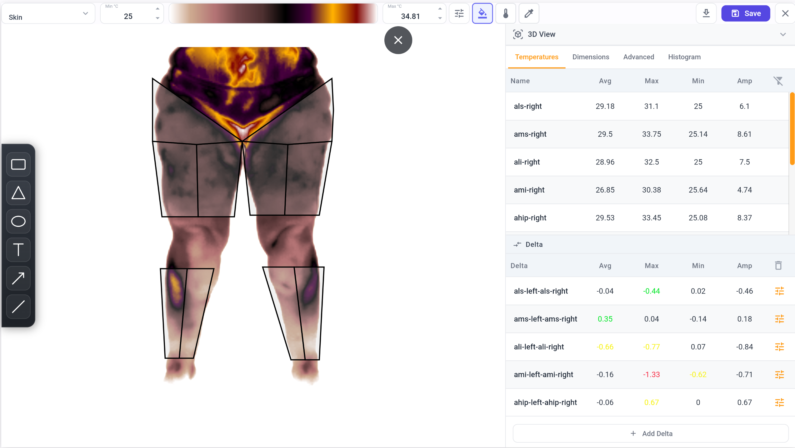 Anterior thermal analysis of the lower limbs in the Vizbodx platform, with demarcated regions of interest and a temperature table.