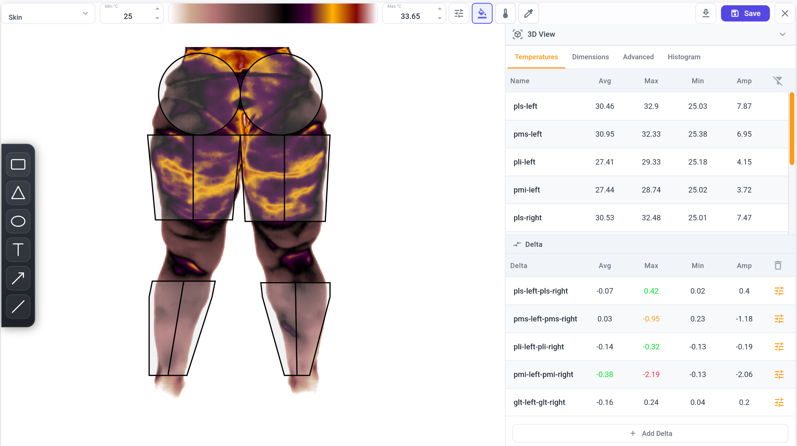 Posterior thermal analysis of the lower limbs in the Vizbodx platform, with a table of thermal deltas between left and right sides.